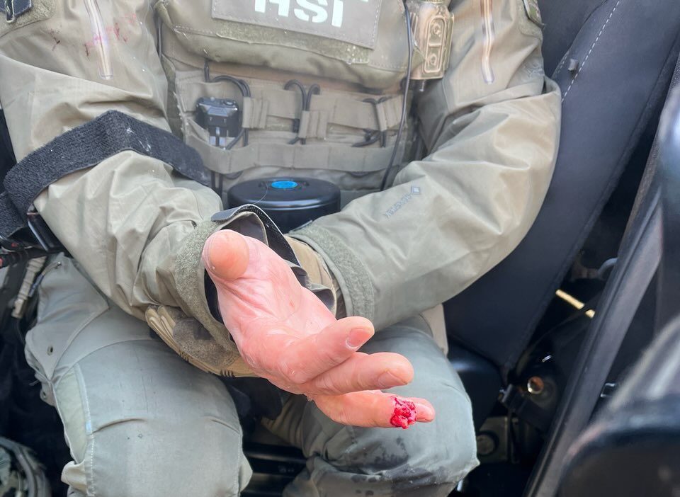 Minneapolis protester allegedly bit finger off of federal&nbsp;agent